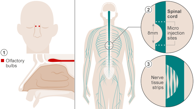 _78392534_spinal_cord_624.