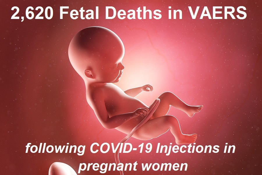 2620-fetal-deaths.