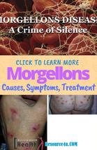 36x%2Ffa%2Fb6%2Fef%2Ffab6efa1f549d895f80d184e785e3e0c.&fb_obo=1&utld=pinimg.com&stp=c0.5000x0.