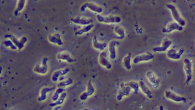 823868_070215-cdc-brain-eating-naegleria-img.