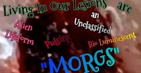 &h=250&url=https%3A%2F%2Fi.ytimg.com%2Fvi%2FP_LlmIuJehU%2Fhqdefault.&cfs=1&ext=&utld=ytimg.