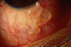 images?q=tbn:ANd9GcS1MA4tUcIAooMt56vl5IitEqErvo_tlNdFpj69LHlJr9aCGpQG.