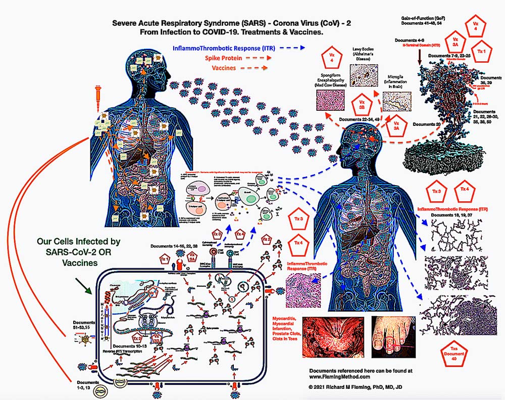 sars-cov-infection-dr-richard-fleming.