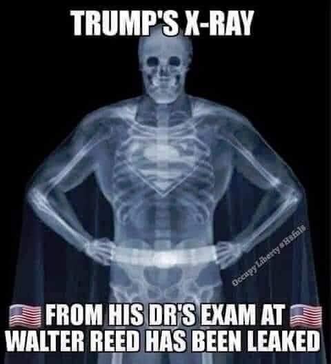 trumpsxray.