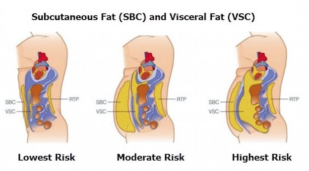 visceral-fat-health-risks.